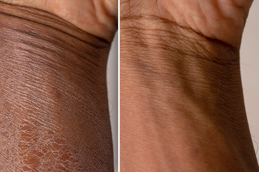 moisturising hydrating skincare body care