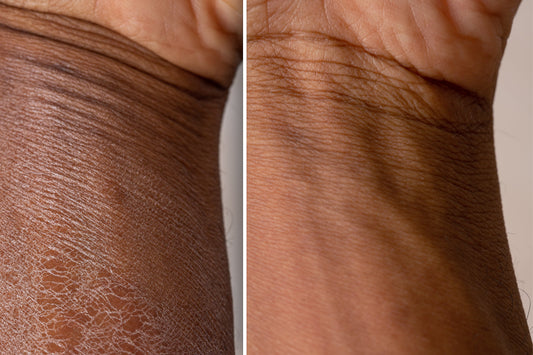 moisturising hydrating skincare body care